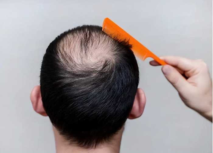 人能活多久看头发就能知道？医生：寿命长的人，头发会有这些特征